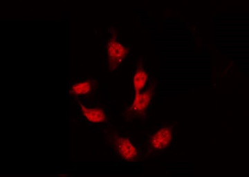 GATA4 Antibody - Staining 293 cells by IF/ICC. The samples were fixed with PFA and permeabilized in 0.1% Triton X-100, then blocked in 10% serum for 45 min at 25°C. The primary antibody was diluted at 1:200 and incubated with the sample for 1 hour at 37°C. An Alexa Fluor 594 conjugated goat anti-rabbit IgG (H+L) Ab, diluted at 1/600, was used as the secondary antibody.