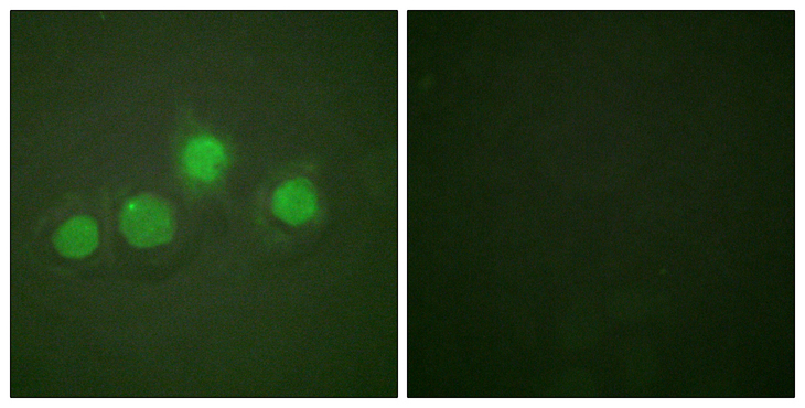 GATA4 Antibody - Immunofluorescence analysis of HUVEC cells, using GATA4 (Phospho-Ser262) Antibody. The picture on the right is blocked with the phospho peptide.