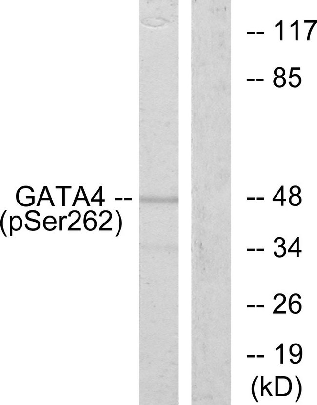 GATA4 Antibody - Western blot analysis of lysates from 293 cells, using GATA4 (Phospho-Ser262) Antibody. The lane on the right is blocked with the phospho peptide.