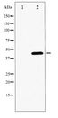 GATA4 Antibody - Western blot of GATA4 phosphorylation expression in 293 whole cell lysates,The lane on the left is treated with the antigen-specific peptide.