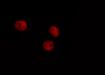 GATA4 Antibody - Staining HuvEc cells by IF/ICC. The samples were fixed with PFA and permeabilized in 0.1% saponin prior to blocking in 10% serum for 45 min at 37°C. The primary antibody was diluted 1/400 and incubated with the sample for 1 hour at 37°C. A Alexa Fluor 594 conjugated goat polyclonal to rabbit IgG (H+L), diluted 1/600 was used as secondary antibody.