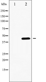 GATA4 Antibody - Western blot analysis of GATA4 phosphorylation expression in 293 whole cells lysates. The lane on the left is treated with the antigen-specific peptide.