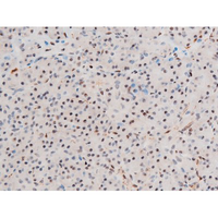 GATA4 Antibody - 1:200 staining human pancreas tissue by IHC-P. The tissue was formaldehyde fixed and a heat mediated antigen retrieval step in citrate buffer was performed. The tissue was then blocked and incubated with the antibody for 1.5 hours at 22°C. An HRP conjugated goat anti-rabbit antibody was used as the secondary.