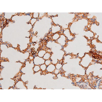 GATA4 Antibody - 1:200 staining mouse lung tissue by IHC-P. The tissue was formaldehyde fixed and a heat mediated antigen retrieval step in citrate buffer was performed. The tissue was then blocked and incubated with the antibody for 1.5 hours at 22°C. An HRP conjugated goat anti-rabbit antibody was used as the secondary.