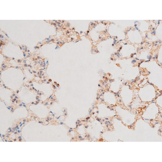 GATA4 Antibody - 1:200 staining rat lung tissue by IHC-P. The tissue was formaldehyde fixed and a heat mediated antigen retrieval step in citrate buffer was performed. The tissue was then blocked and incubated with the antibody for 1.5 hours at 22°C. An HRP conjugated goat anti-rabbit antibody was used as the secondary.