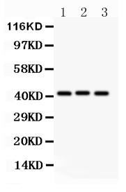 GATA5 Antibody - GATA5 antibody Western blot. All lanes: Anti GATA5 at 0.5 ug/ml. Lane 1: Rat Liver Tissue Lysate at 50 ug. Lane 2: Rat Brain Tissue Lysate at 50 ug. Lane 3: Rat Ovary Tissue Lysate at 50 ug. Predicted band size: 42 kD. Observed band size: 42 kD.
