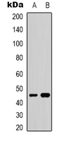GATA5 Antibody - Western blot analysis of GATA5 expression in HepG2 (A); NIH3T3 (B) whole cell lysates.