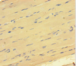 GATA5 Antibody - Immunohistochemistry of paraffin-embedded human skeletal muscle tissue at dilution 1:100