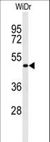GATA6 Antibody - Western blot of Phospho-GATA6-pY271 in WiDr cell line lysates (35 ug/lane). GATA6 (arrow) was detected using the purified antibody.