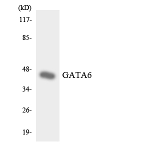 GATA6 Antibody - Western blot analysis of the lysates from HepG2 cells using GATA6 antibody.