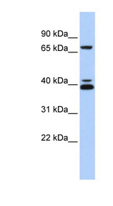GATA6 Antibody - GATA6 antibody Western blot of MCF7 cell lysate. This image was taken for the unconjugated form of this product. Other forms have not been tested.