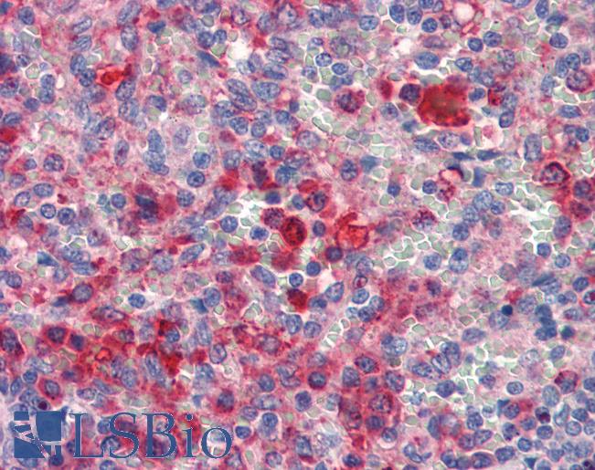 GATA6 Antibody - Anti-GATA6 antibody IHC of human spleen. Immunohistochemistry of formalin-fixed, paraffin-embedded tissue after heat-induced antigen retrieval. Antibody concentration 5 ug/ml.  This image was taken for the unconjugated form of this product. Other forms have not been tested.