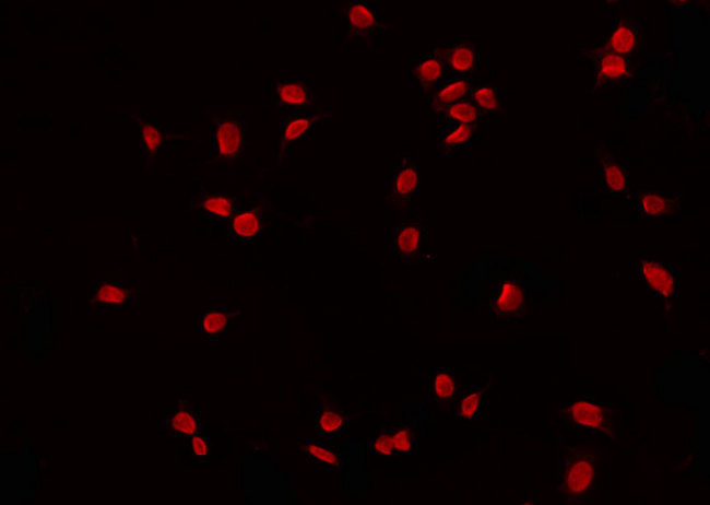 GATA6 Antibody - Staining 293 cells by IF/ICC. The samples were fixed with PFA and permeabilized in 0.1% Triton X-100, then blocked in 10% serum for 45 min at 25°C. The primary antibody was diluted at 1:200 and incubated with the sample for 1 hour at 37°C. An Alexa Fluor 594 conjugated goat anti-rabbit IgG (H+L) Ab, diluted at 1/600, was used as the secondary antibody.