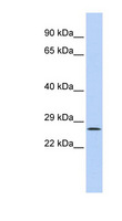 GATAD1 Antibody - GATAD1 antibody Western blot of HepG2 cell lysate. This image was taken for the unconjugated form of this product. Other forms have not been tested.