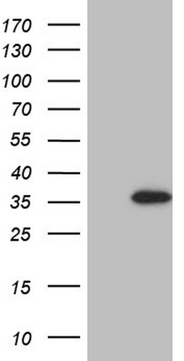 GATAD1 Antibody - HEK293T cells were transfected with the pCMV6-ENTRY control. (Left lane) or pCMV6-ENTRY GATAD1. (Right lane) cDNA for 48 hrs and lysed. Equivalent amounts of cell lysates. (5 ug per lane) were separated by SDS-PAGE and immunoblotted with anti-GATAD1.