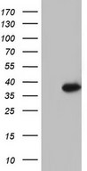 GATAD1 Antibody - HEK293T cells were transfected with the pCMV6-ENTRY control. (Left lane) or pCMV6-ENTRY GATAD1. (Right lane) cDNA for 48 hrs and lysed. Equivalent amounts of cell lysates. (5 ug per lane) were separated by SDS-PAGE and immunoblotted with anti-GATAD1.