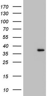 GATAD1 Antibody - HEK293T cells were transfected with the pCMV6-ENTRY control. (Left lane) or pCMV6-ENTRY GATAD1. (Right lane) cDNA for 48 hrs and lysed. Equivalent amounts of cell lysates. (5 ug per lane) were separated by SDS-PAGE and immunoblotted with anti-GATAD1.