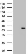 GATAD1 Antibody - HEK293T cells were transfected with the pCMV6-ENTRY control (Left lane) or pCMV6-ENTRY GATAD1 (Right lane) cDNA for 48 hrs and lysed. Equivalent amounts of cell lysates (5 ug per lane) were separated by SDS-PAGE and immunoblotted with anti-GATAD1.