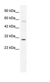 GATAD1 Antibody - K562 Cell Lysate.  This image was taken for the unconjugated form of this product. Other forms have not been tested.