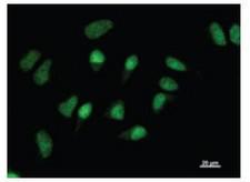 GATAD1 Antibody - Immunofluorescent staining using GATAD1 antibody. Immunostaining analysis in HeLa cells. HeLa cells were fixed with 4% paraformaldehyde and permeabilized with 0.01% Triton-X100 in PBS. The cells were immunostained with anti-GATAD1 antibody.