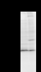GATAD1 Antibody - Detection of GATAD1 by Western blot. Samples: Whole cell lysate from human A2058 (H, 50 ug) and mouse NIH3T3 (M, 50 ug) cells. Predicted molecular weight: 28 kDa