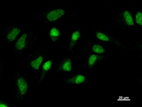 GATAD1 Antibody - Immunostaining analysis in HeLa cells. HeLa cells were fixed with 4% paraformaldehyde and permeabilized with 0.1% Triton X-100 in PBS. The cells were immunostained with anti-GATAD1 mAb.