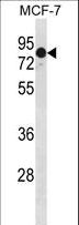 GATAD2A Antibody - GATAD2A Antibody western blot of HeLa cell line lysates (35 ug/lane). The GATAD2A antibody detected the GATAD2A protein (arrow).