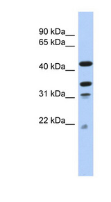 GATAD2A Antibody - GATAD2A antibody Western blot of THP-1 cell lysate. This image was taken for the unconjugated form of this product. Other forms have not been tested.