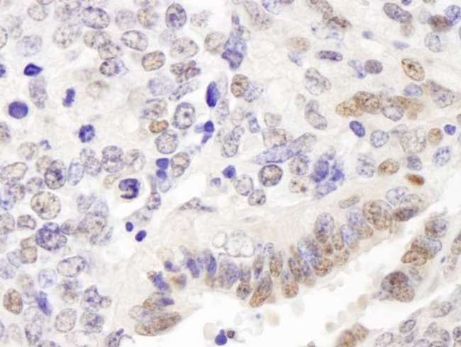 GATAD2A Antibody - Detection of Mouse p66alpha by Immunohistochemistry. Sample: FFPE section of mouse teratoma. Antibody: Affinity purified rabbit anti-p66alpha used at a dilution of 1:250.