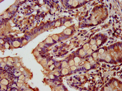 GATAD2A Antibody - Immunohistochemistry image at a dilution of 1:800 and staining in paraffin-embedded human small intestine tissue performed on a Leica BondTM system. After dewaxing and hydration, antigen retrieval was mediated by high pressure in a citrate buffer (pH 6.0) . Section was blocked with 10% normal goat serum 30min at RT. Then primary antibody (1% BSA) was incubated at 4 °C overnight. The primary is detected by a biotinylated secondary antibody and visualized using an HRP conjugated SP system.