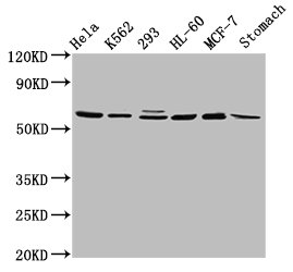 GATAD2A Antibody - Positive Western Blot detected in Hela whole cell lysate, K562 whole cell lysate, 293 whole cell lysate, HL-60 whole cell lysate, MCF-7 whole cell lysate, Rat stomach tissue. All lanes: GATAD2A antibody at 2.9 µg/ml Secondary Goat polyclonal to rabbit IgG at 1/50000 dilution. Predicted band size: 69, 66 KDa. Observed band size: 69 KDa