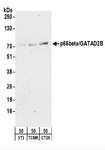 GATAD2B Antibody - Detection of Mouse p66beta/GATAD2B by Western Blot. Samples: Whole cell lysate (50 ug) from NIH3T3, TCMK-1, and CT26.WT cells. Antibodies: Affinity purified rabbit anti-p66beta/GATAD2B antibody used for WB at 0.5 ug/ml. Detection: Chemiluminescence with an exposure time of 3 minutes.