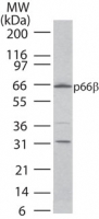 GATAD2B Antibody - Western blot of p66b in 15 ugs of HeLa cell lysate using antibody at4 ug/ml.