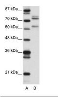 GATAD2B Antibody - A: Marker, B: 293T Cell Lysate.  This image was taken for the unconjugated form of this product. Other forms have not been tested.