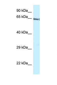 GATAD2B Antibody - GATAD2B antibody Western blot of Mouse Brain lysate. Antibody concentration 1 ug/ml.  This image was taken for the unconjugated form of this product. Other forms have not been tested.