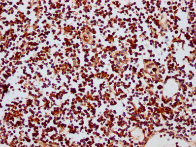 GATAD2B Antibody - Immunohistochemistry Dilution at 1:400 and staining in paraffin-embedded human lymph node tissue performed on a Leica BondTM system. After dewaxing and hydration, antigen retrieval was mediated by high pressure in a citrate buffer (pH 6.0). Section was blocked with 10% normal Goat serum 30min at RT. Then primary antibody (1% BSA) was incubated at 4°C overnight. The primary is detected by a biotinylated Secondary antibody and visualized using an HRP conjugated SP system.