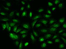 GATAD2B Antibody - Immunofluorescence staining of GATAD2B in U2OS cells. Cells were fixed with 4% PFA, permeabilzed with 0.3% Triton X-100 in PBS, blocked with 10% serum, and incubated with rabbit anti-Human GATAD2B polyclonal antibody (dilution ratio 1:200) at 4°C overnight. Then cells were stained with the Alexa Fluor 488-conjugated Goat Anti-rabbit IgG secondary antibody (green). Positive staining was localized to Nucleus.