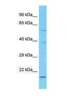GATB / PET112 Antibody - Western blot of Human 721_B. PET112 antibody dilution 1.0 ug/ml.  This image was taken for the unconjugated form of this product. Other forms have not been tested.
