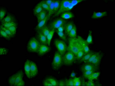 GATB / PET112 Antibody - Immunofluorescence staining of HepG2 cells diluted at 1:100, counter-stained with DAPI. The cells were fixed in 4% formaldehyde, permeabilized using 0.2% Triton X-100 and blocked in 10% normal Goat Serum. The cells were then incubated with the antibody overnight at 4°C.The Secondary antibody was Alexa Fluor 488-congugated AffiniPure Goat Anti-Rabbit IgG (H+L).