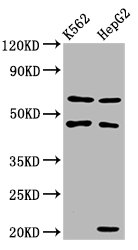 GATB / PET112 Antibody - Western Blot Positive WB detected in: K562 whole cell lysate, HepG2 whole cell lysate All Lanes: GATB antibody at 3.4µg/ml Secondary Goat polyclonal to rabbit IgG at 1/50000 dilution Predicted band size: 62 KDa Observed band size: 62 KDa
