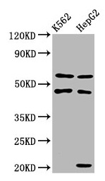 GATB / PET112 Antibody - Western Blot Positive WB detected in: K562 whole cell lysate, HepG2 whole cell lysate All lanes: GATB antibody at 3.4µg/ml Secondary Goat polyclonal to rabbit IgG at 1/50000 dilution Predicted band size: 62 kDa Observed band size: 62 kDa