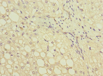 GATC Antibody - Immunohistochemistry of paraffin-embedded human liver tissue at dilution 1:100