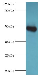 GATM / AGAT Antibody - Western blot. All lanes: Glycine amidinotransferase, mitochondrial antibody at 2 ug/ml+mouse kidney tissue. Secondary antibody: Goat polyclonal to rabbit at 1:10000 dilution. Predicted band size: 48 kDa. Observed band size: 48 kDa Immunohistochemistry.