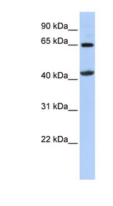 GATM / AGAT Antibody - Anti-GATM antibody western blot of 721_B cell lysate.  This image was taken for the unconjugated form of this product. Other forms have not been tested.