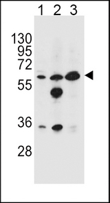 GATM / AGAT Antibody - GATM Antibody western blot of HL-60(lane 1),MDA-MB453(lane 2),K562(lane 3) cell line lysates (35 ug/lane). The GATM antibody detected the GATM protein (arrow).