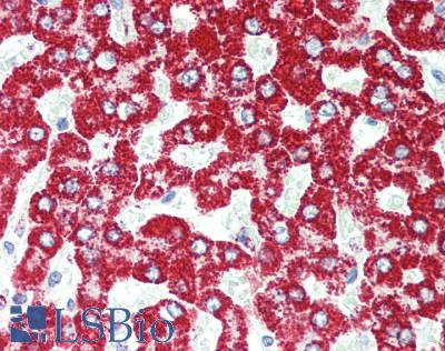 GATM / AGAT Antibody - Human Liver: Formalin-Fixed, Paraffin-Embedded (FFPE), at a dilution of 1:50.