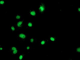 GATM / AGAT Antibody - Anti-GATM mouse monoclonal antibody immunofluorescent staining of COS7 cells transiently transfected by pCMV6-ENTRY GATM.