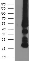 GATM / AGAT Antibody - HEK293T cells were transfected with the pCMV6-ENTRY control (Left lane) or pCMV6-ENTRY GATM (Right lane) cDNA for 48 hrs and lysed. Equivalent amounts of cell lysates (5 ug per lane) were separated by SDS-PAGE and immunoblotted with anti-GATM.