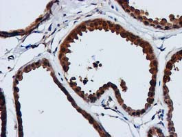 GATM / AGAT Antibody - IHC of paraffin-embedded Human breast tissue using anti-GATM mouse monoclonal antibody. (Heat-induced epitope retrieval by 10mM citric buffer, pH6.0, 100C for 10min).