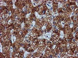 GATM / AGAT Antibody - IHC of paraffin-embedded Human liver tissue using anti-GATM mouse monoclonal antibody. (Heat-induced epitope retrieval by 10mM citric buffer, pH6.0, 100C for 10min).